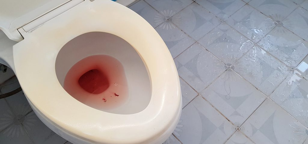 Blood In Urine