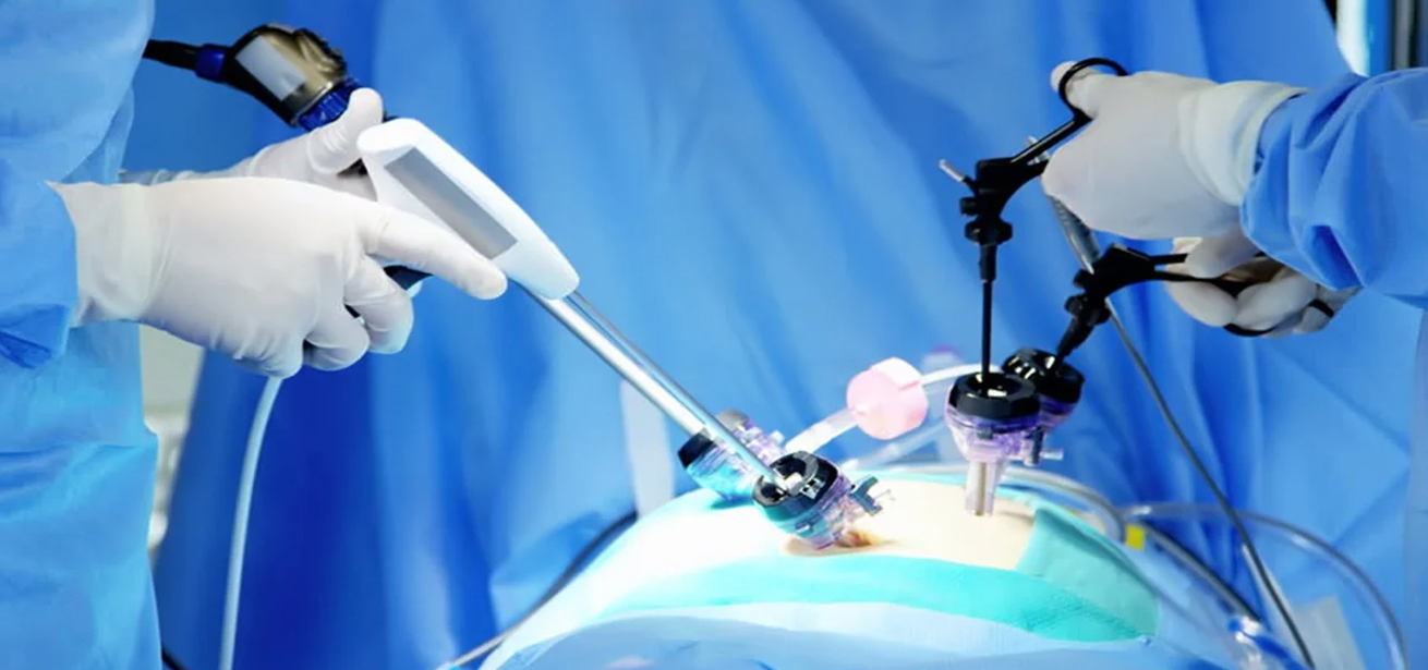 Pyeloplasty
